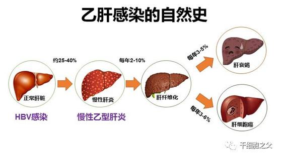 肝病治疗最新进展，突破与创新研究综述